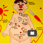 El bosque quemado del cuerpo – Fernando Aduriz